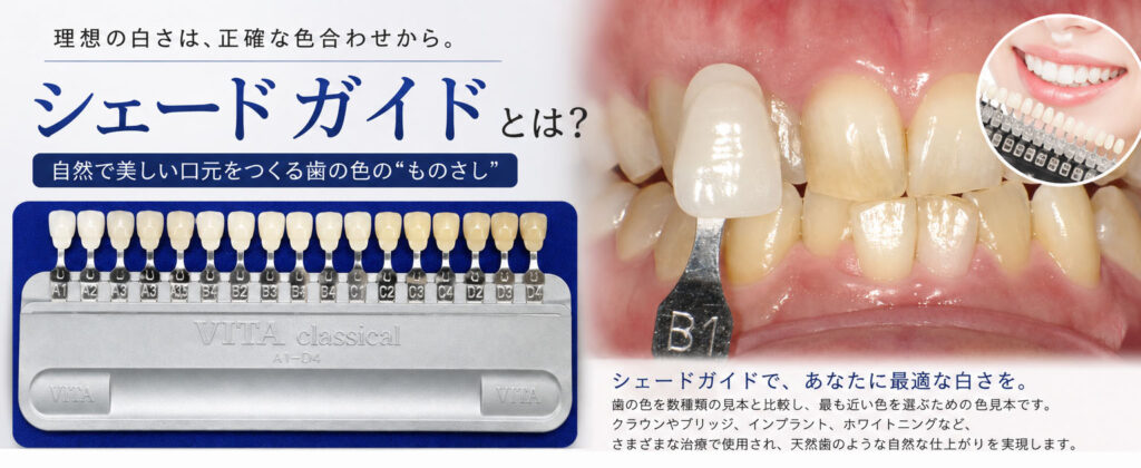 シェードガイドとは？