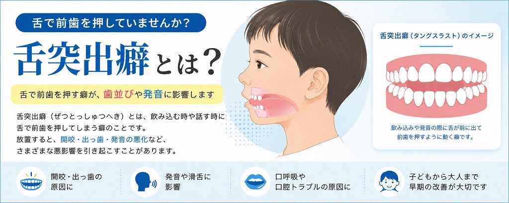 舌突出癖とは?