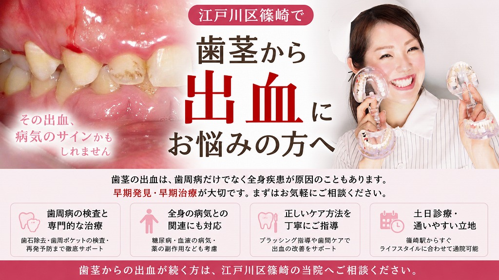江戸川区篠崎で「歯茎から出血」にお悩みの方へ