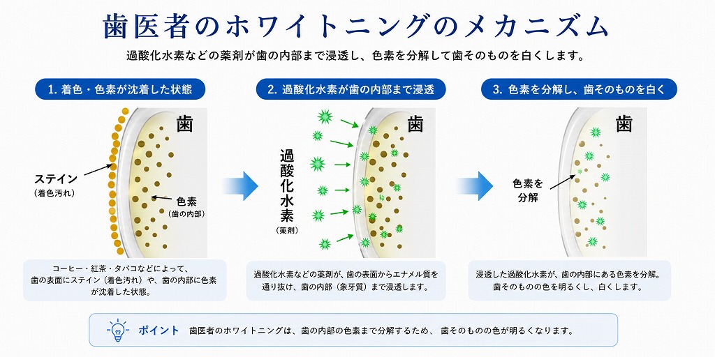歯医者のホワイトニングのメカニズム