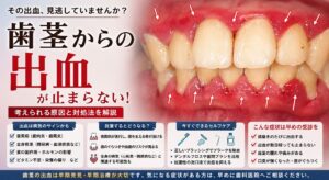 歯茎からの出血が止まらない