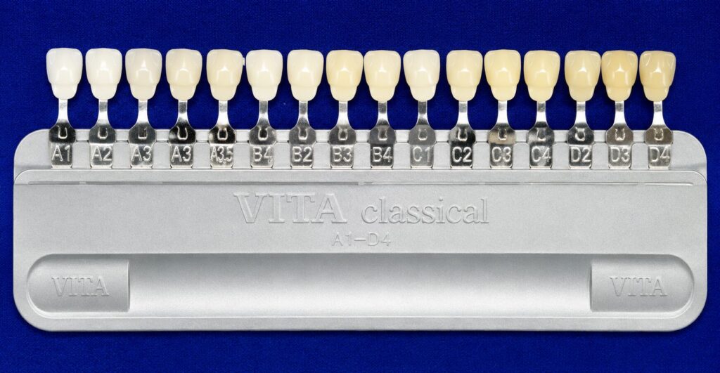 VITAクラシック