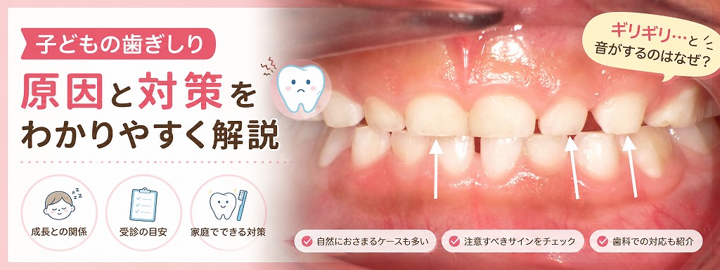 子どもの歯ぎしり原因・対策