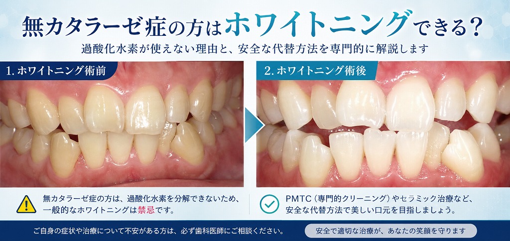 無カタラーゼ症の方はホワイトニングできる？