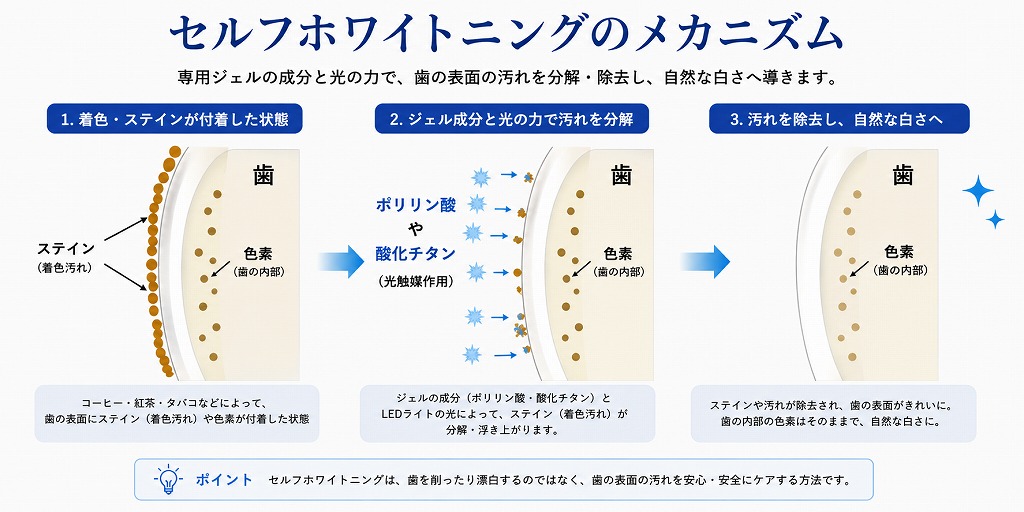 セルフホワイトニングのメカニズム