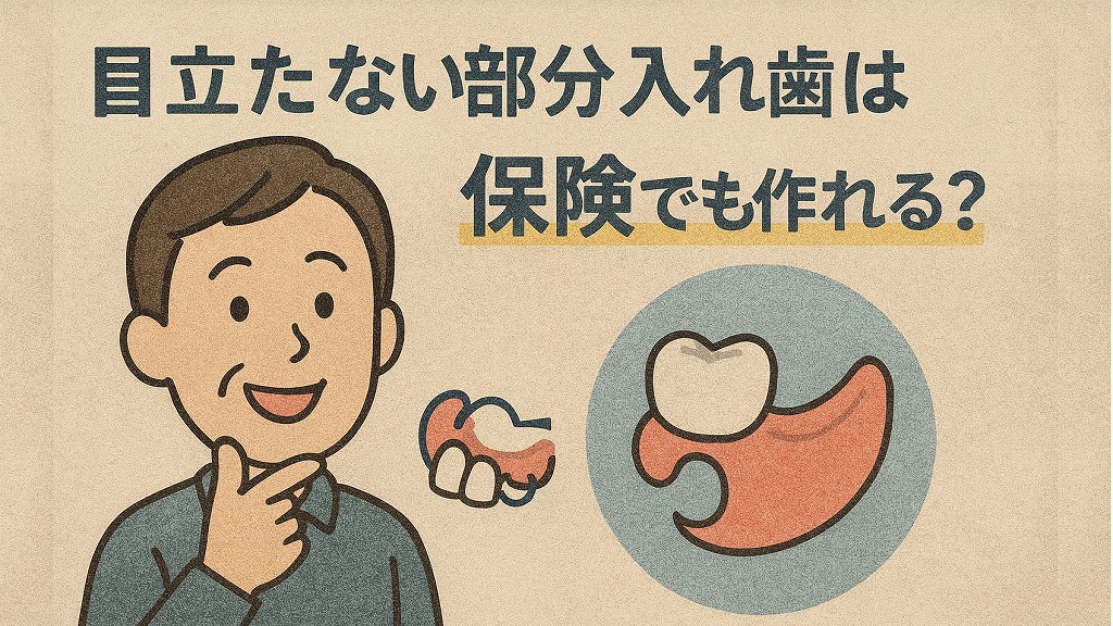 目立たない部分入れ歯は保険でも作れる?