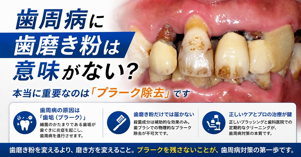 歯周病に歯磨き粉は意味がない？