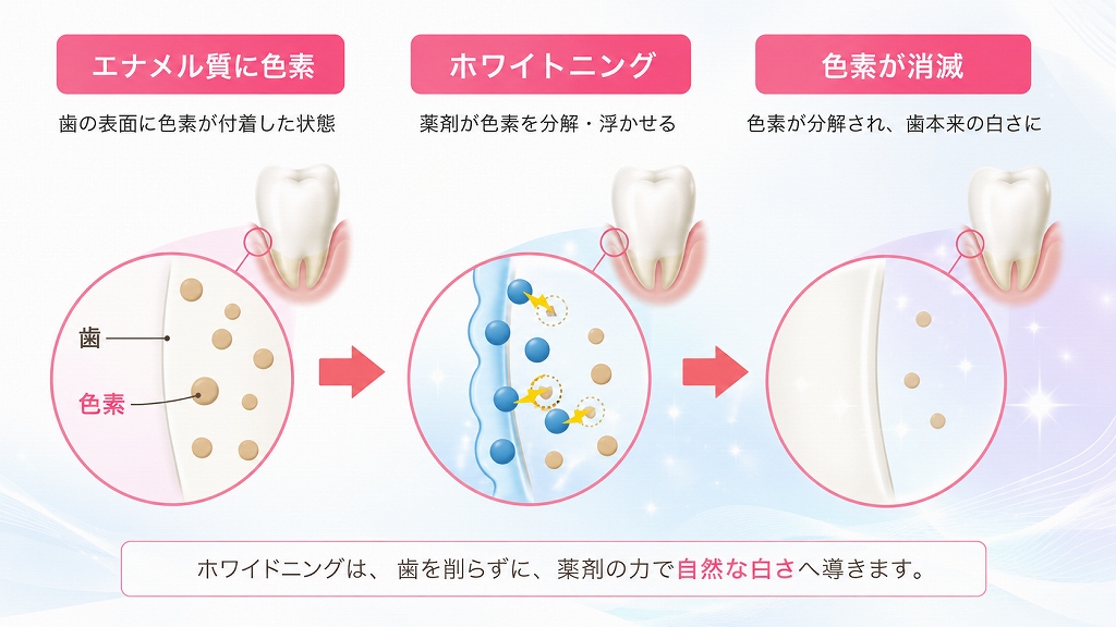 歯科ホワイトニングの仕組み