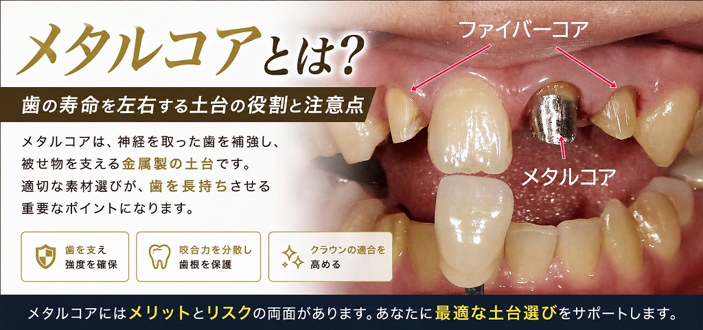 メタルコアとは？