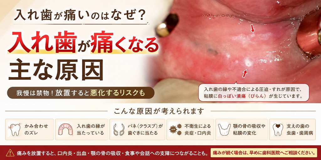 入れ歯が痛くなる主な原因