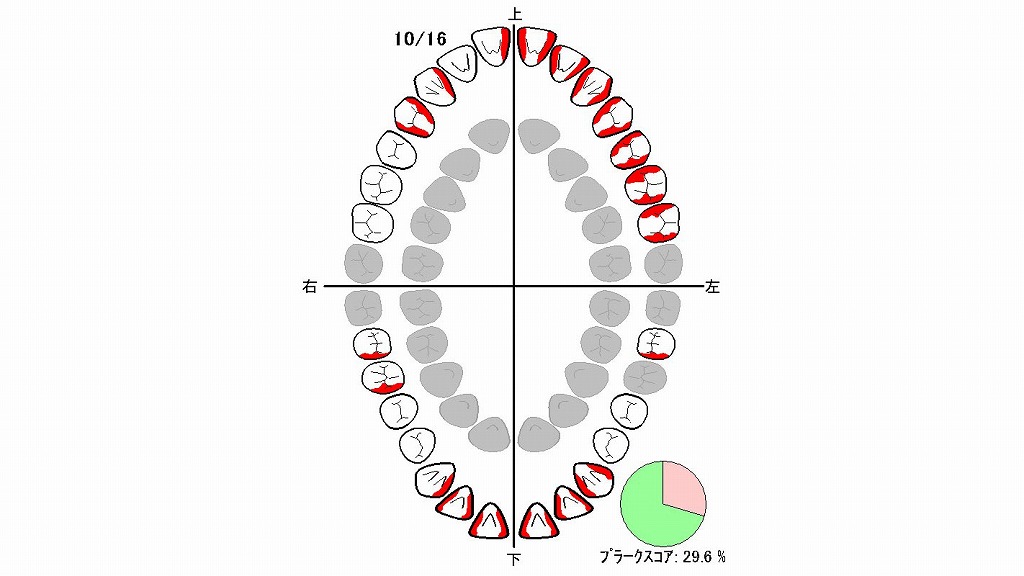 プラークスコア