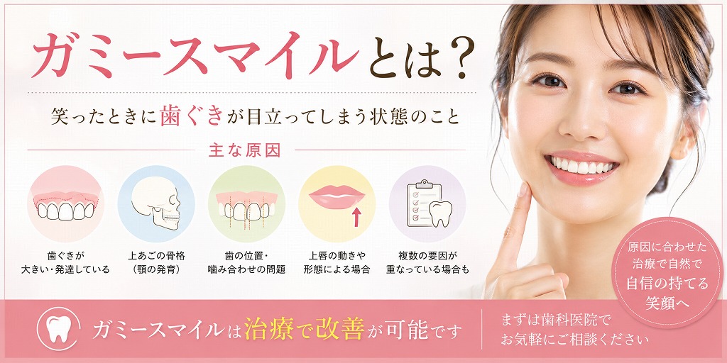 ガミースマイルとは