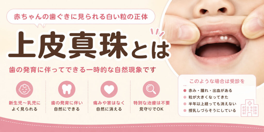 上皮真珠とは？