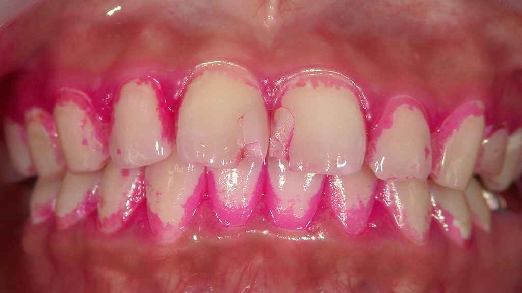 つわり中でもできる！無理なく続ける歯磨きの工夫