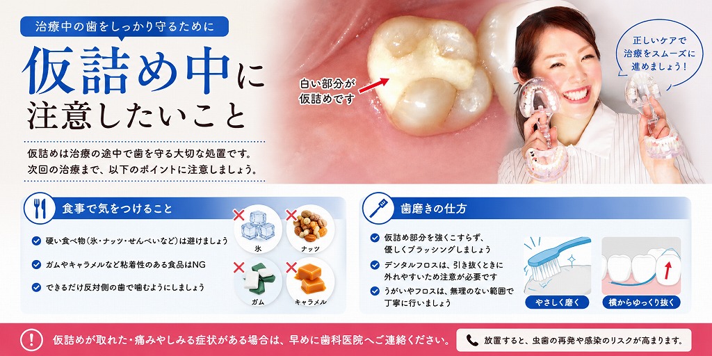 仮詰め中に注意したいこと