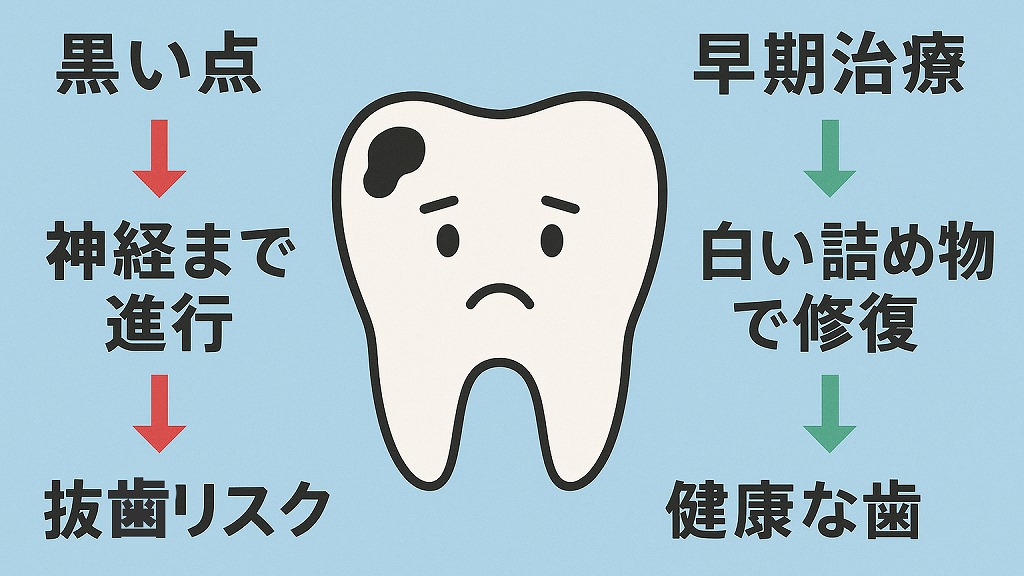黒い虫歯を放置するとどうなる？
