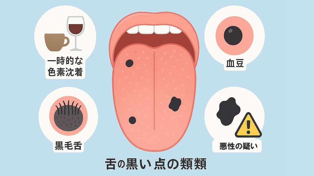 舌の黒い点の種類