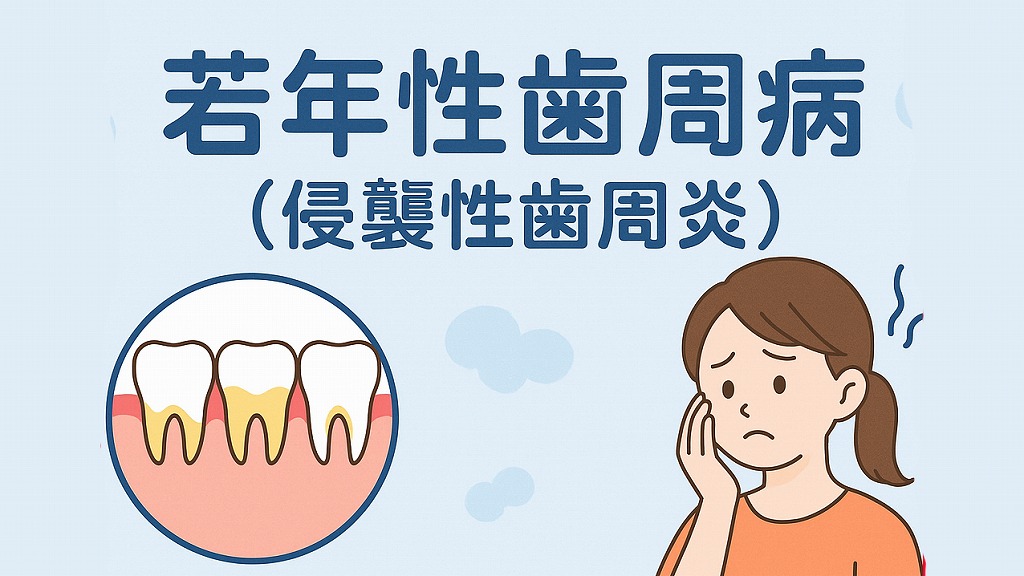 若年性歯周病(侵襲性歯周炎)