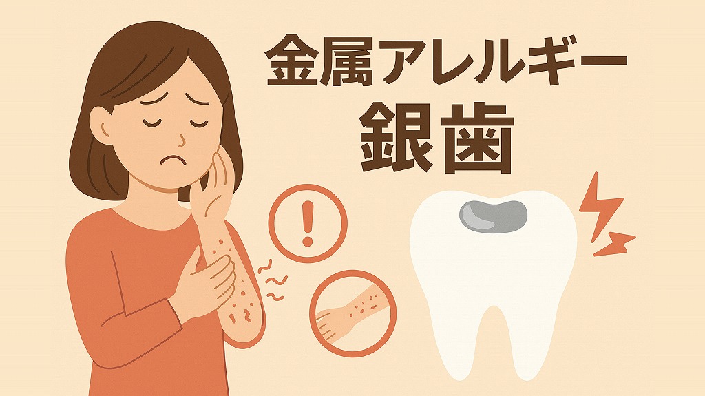 銀歯と金属アレルギーの関係