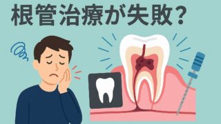 ⚠裁断済　根管治療で失敗する本当の理由 難症例・トラブル・再根管治療を克服する… 根管治療で失敗する本当の理由 - クインテッセンス出版