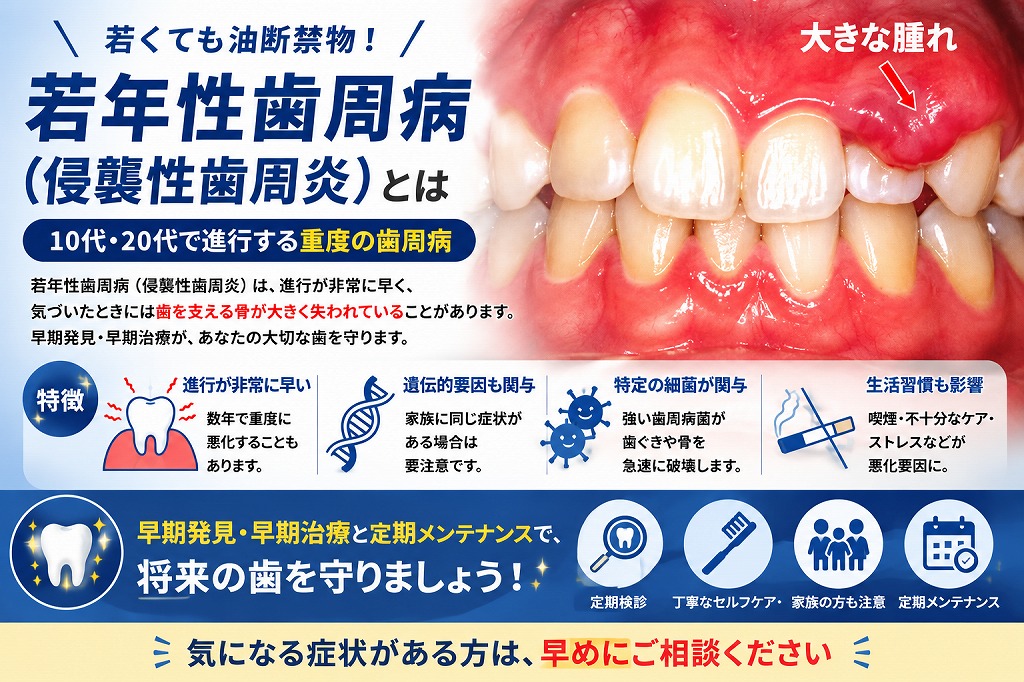 若年性歯周病（侵襲性歯周炎）とは？若くても進行する歯周病の症状