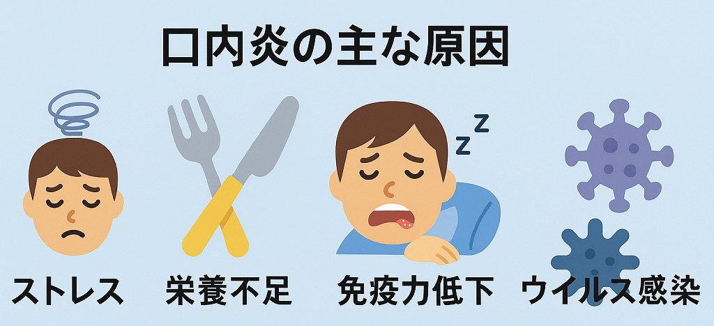 口内炎の主な原因