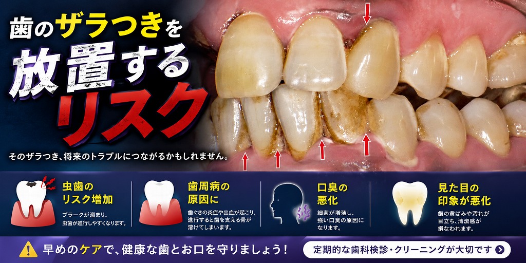 歯のザラつきを放置するリスク