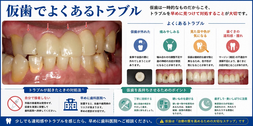 仮歯とは？治療中の歯を守り、理想の被せ物へ導く重要なステップ