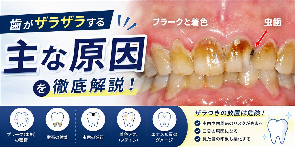 歯がザラザラする主な原因