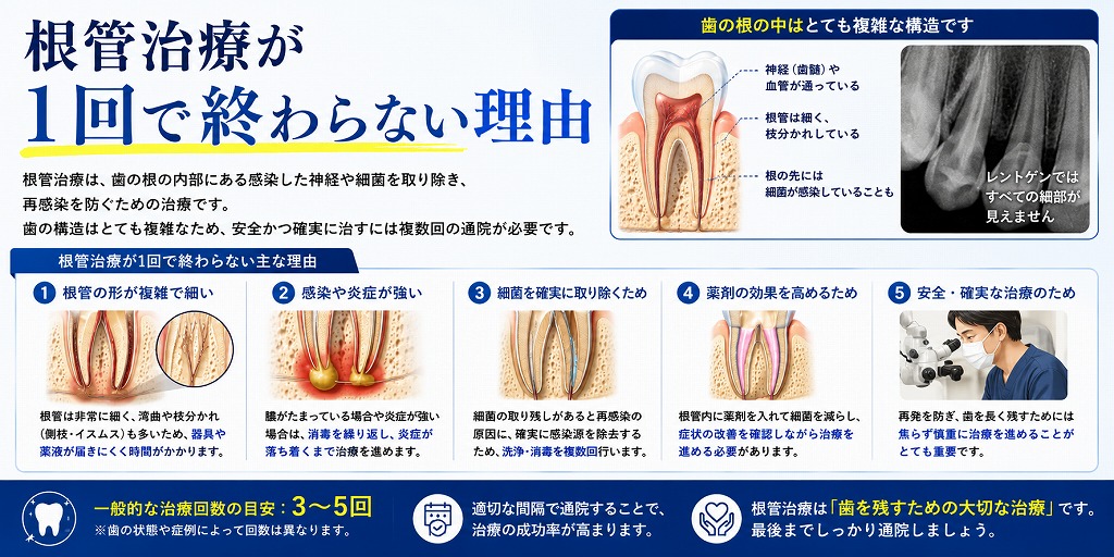 根管治療が1回で終わらない理由