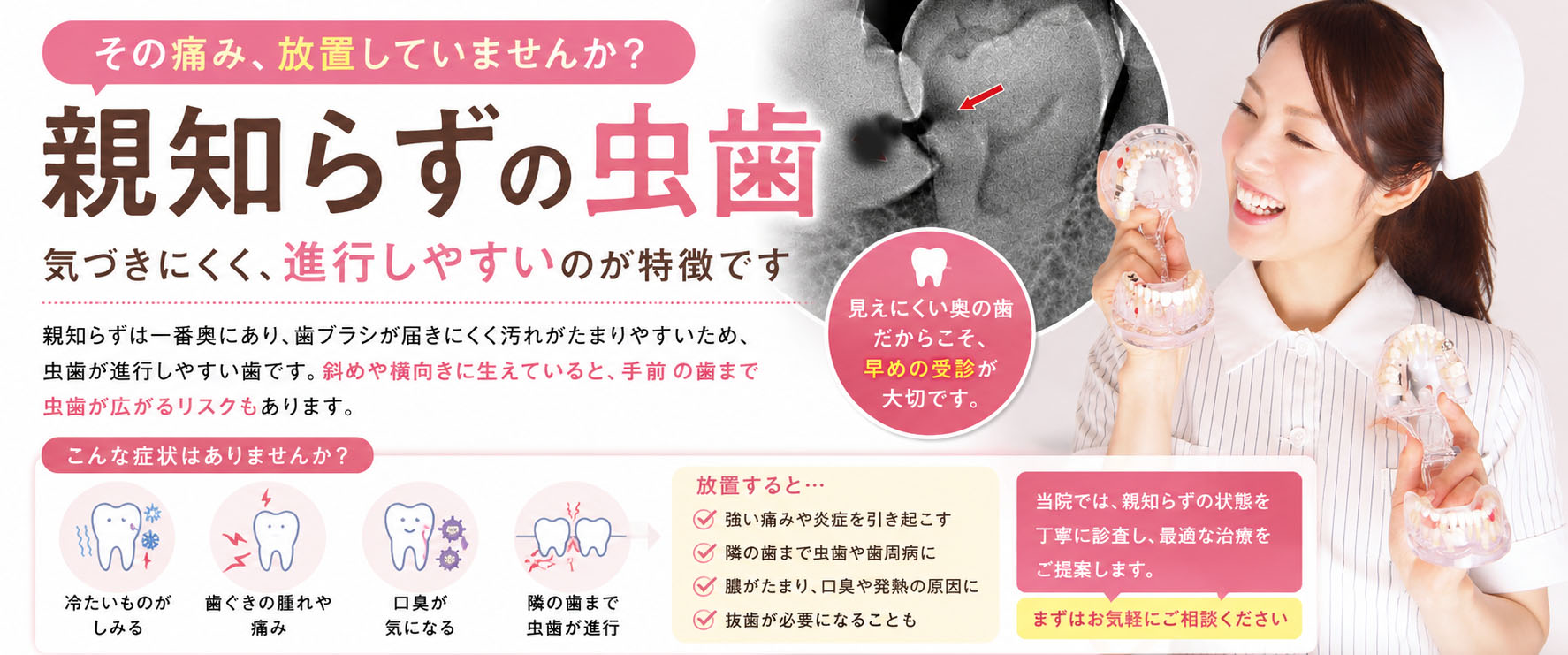 江戸川区篠崎で親知らずの虫歯にお悩みの方へ