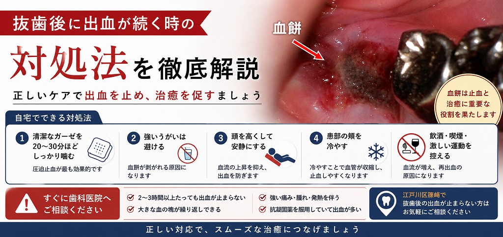 抜歯後に出血が続く時の対処法