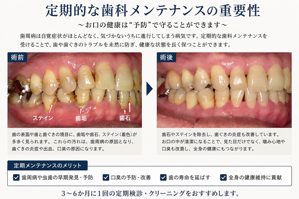 定期的な歯科メンテナンスを受ける