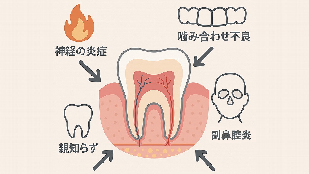 虫歯が原因で頭痛が起こるケース