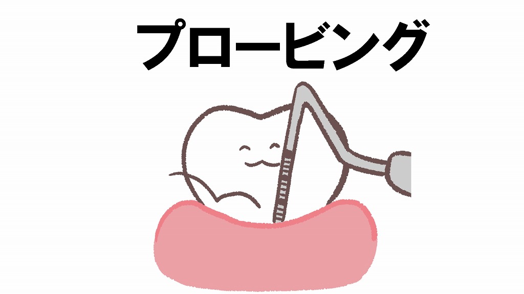 プロービング