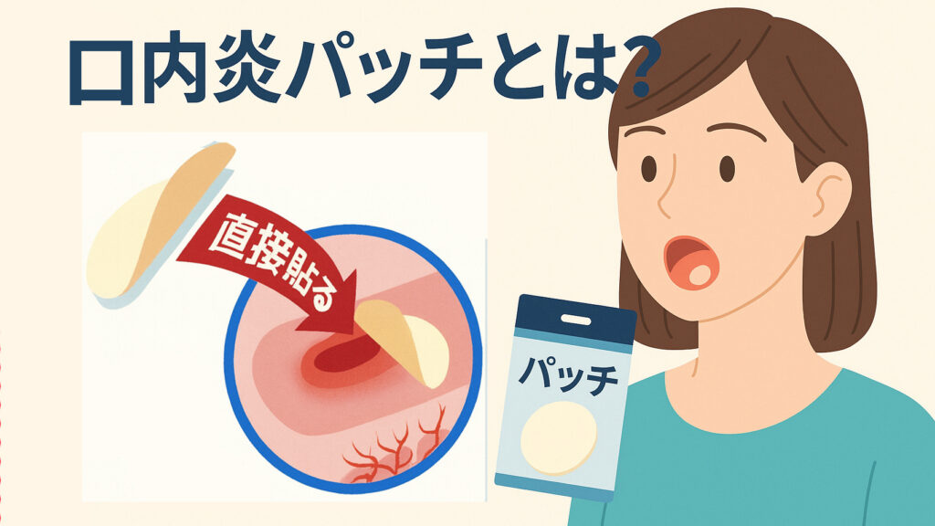 口内炎パッチとは？