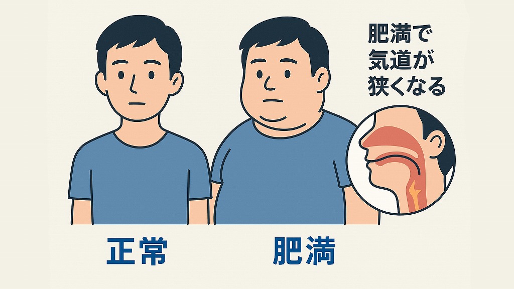 肥満と首回りの脂肪