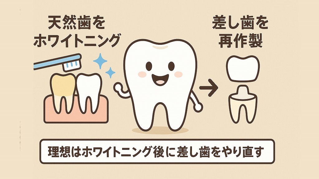 ホワイトニング後に差し歯をやり直す