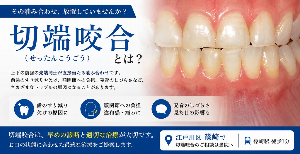 切端咬合とは?