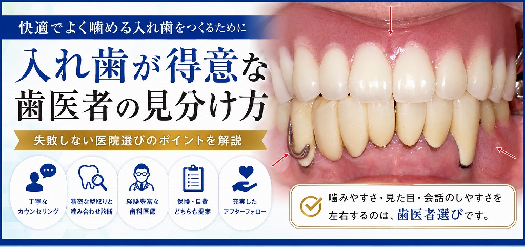 入れ歯が得意な歯医者の見分け方
