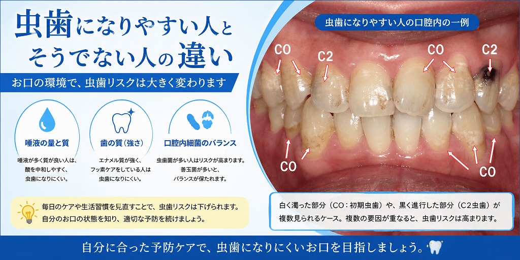 虫歯になりやすい人と、なりにくい人の違い