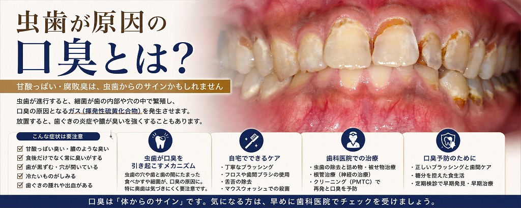 虫歯が原因の口臭とは？