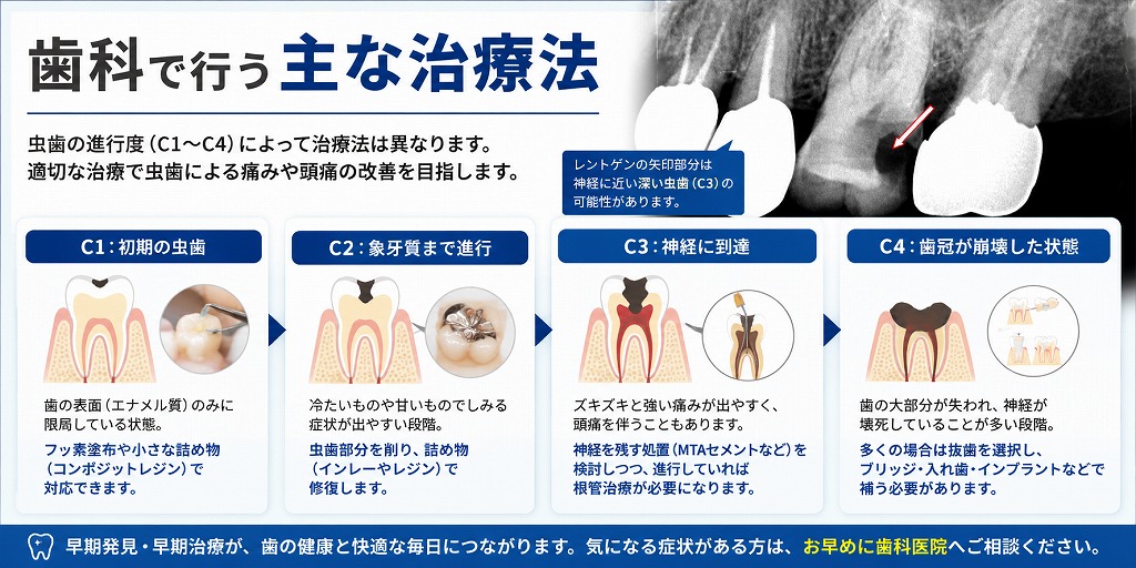 歯科で行う主な治療法