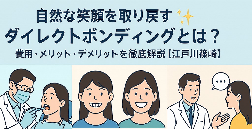ダイレクトボンディングとは?