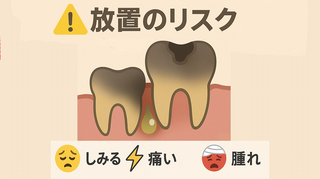 奥歯の虫歯を放置するリスク
