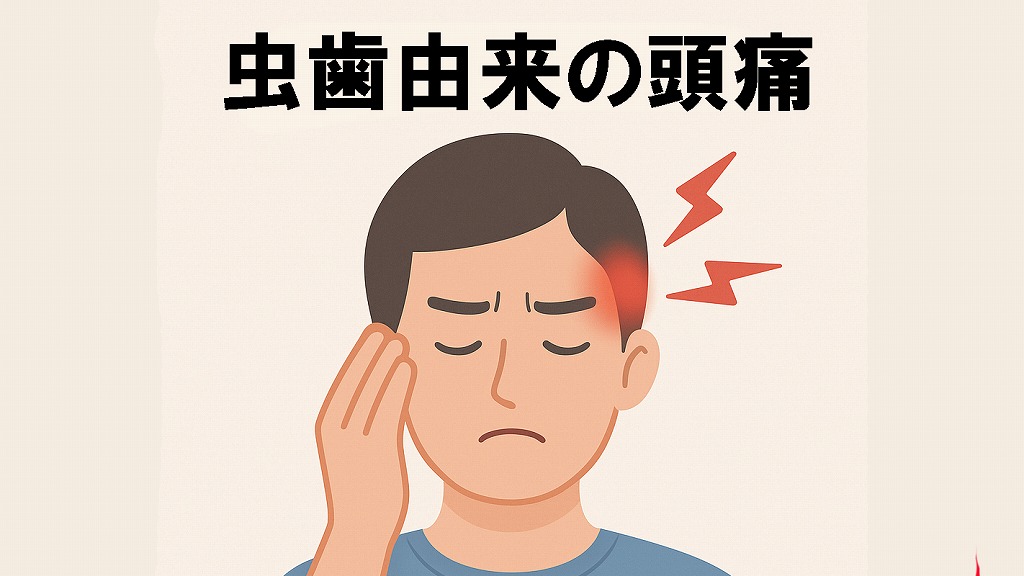 虫歯由来の頭痛