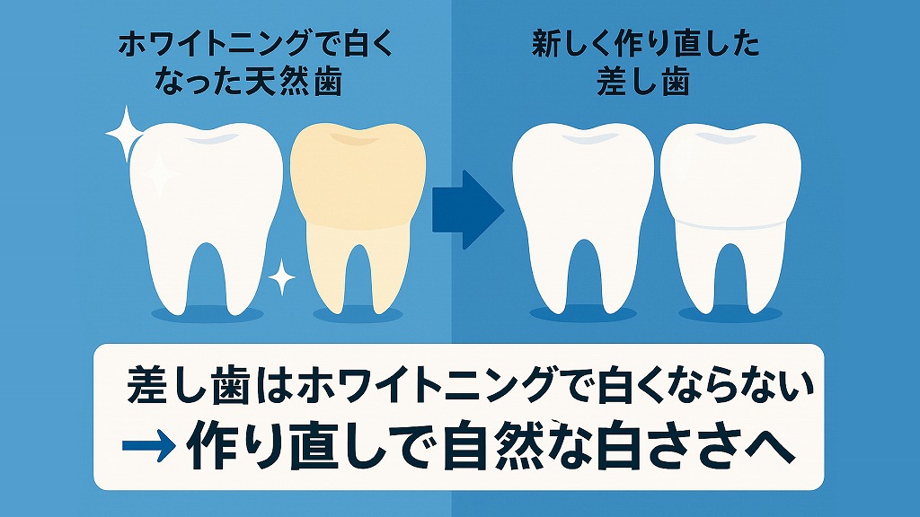 差し歯はホワイトニングで白くならない