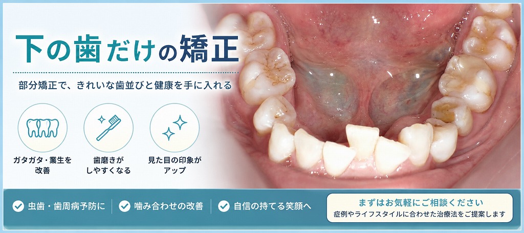 下の歯だけの矯正