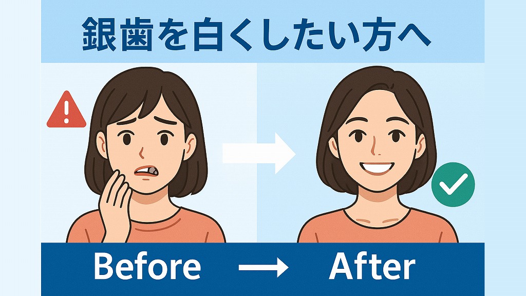 銀歯を白くしたい方へ