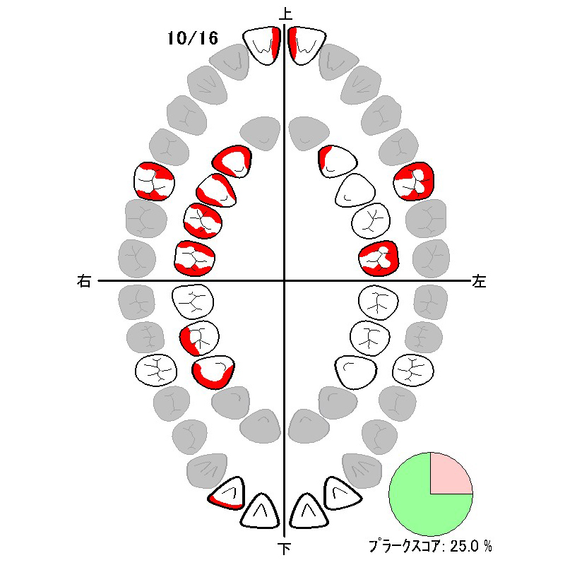 2枚目：改善後（10月16日）